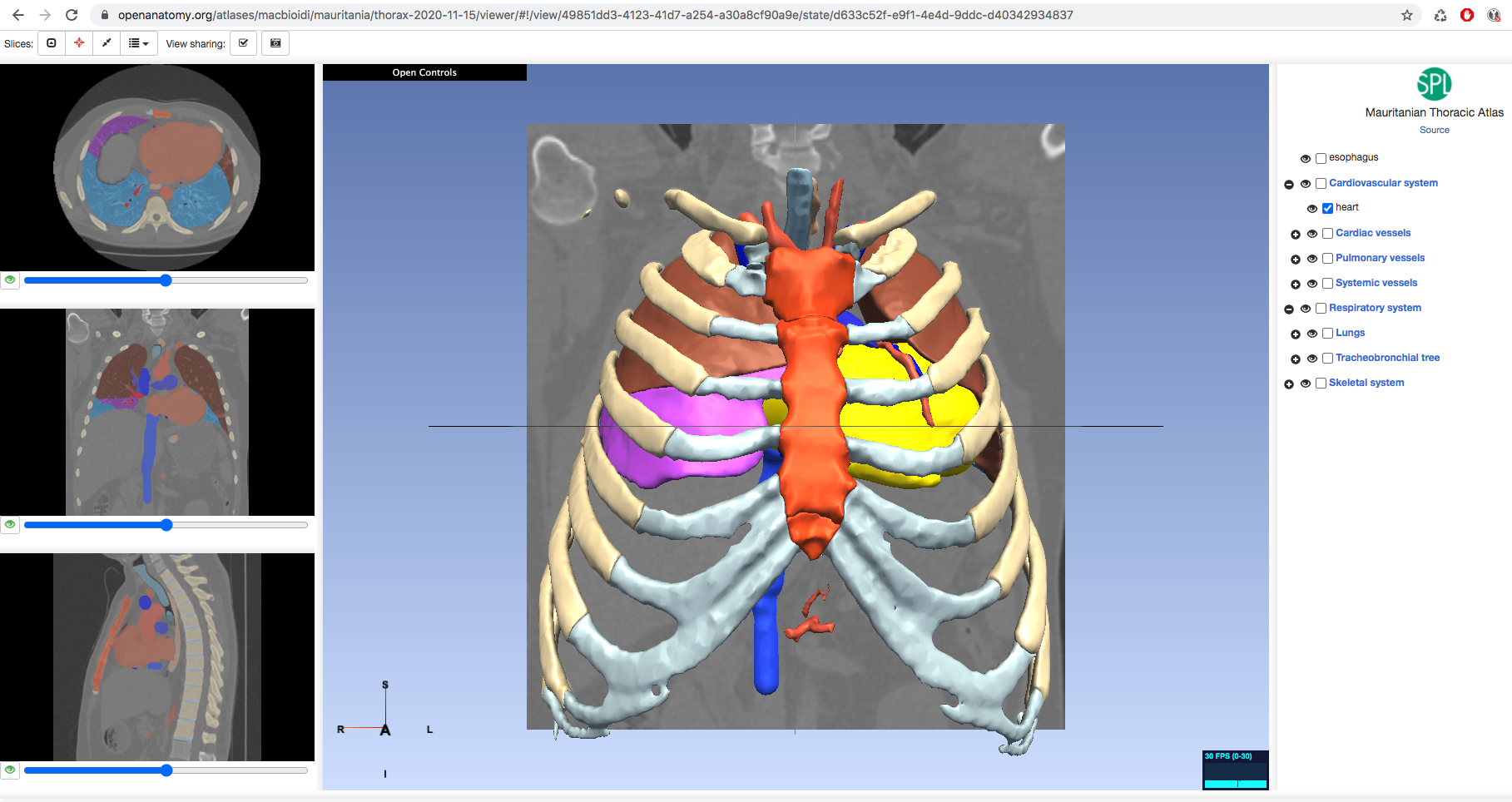 Open Anatomy Project